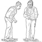 Blocq’s Disease: When the Body Speaks the Mind